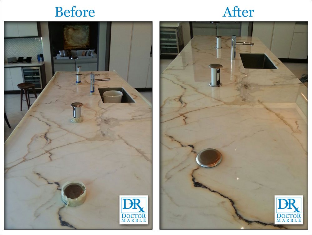Gallery Doctor Marble Restoration